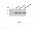 Fig. 07 - RECOMBINANT CHICKEN INTERLEUKIN-1 BETA PROTEIN FOR PRODUCING ANTIBODY EARLY AND RETAINING FOR A LONGER PERIOD OF TIME AND APPLICATION THEREOF