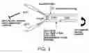 Fig. 02 - α1-antitrypsin compositions and methods of treating autoimmune diseases