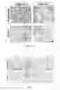 Fig. 02 - Local orbital therapy for thyroid eye disease