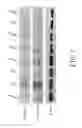 Fig. 02 - Method for preparing collagen having regeneration and repair effects from Wharton's Jelly mesenchymal stem cells