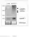 Fig. 13 - Novel Paratransgenic System for the Biocontrol of Disease-Transmitting Mosquitos