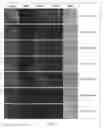 Fig. 26 - Novel Paratransgenic System for the Biocontrol of Disease-Transmitting Mosquitos