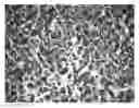 Fig. 01 - Coating Composition and Method