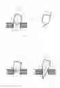 Fig. 02 - FACADE PANEL SCREW AND FASTENING ARRANGEMENT COMPRISING SAME