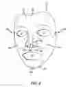 Fig. 07 - FACIAL ALIGNMENT SYSTEM