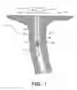 Fig. 02 - Flow meter and method for measuring fluid flow