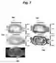 Fig. 06 - Deep learning method for nonstationary image artifact correction
