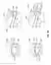 Fig. 07 - LAMINATED LENSES WITH ANTI-FOGGING FUNCTIONALITY