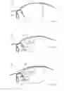 Fig. 06 - SPECTACLE FRAME, SPECTACLES, AND METHOD FOR MANUFACTURING SPECTACLES