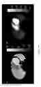 Fig. 09 - Method and system for modelling a human heart and atria