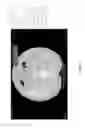 Fig. 22 - Medical scan image analysis system