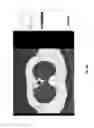 Fig. 41 - Medical scan image analysis system