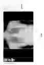 Fig. 43 - Medical scan image analysis system
