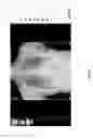 Fig. 44 - Medical scan image analysis system