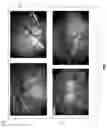 Fig. 08 - Methods and systems for using multiple data structures to process surgical data
