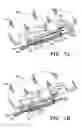 Fig. 08 - Beam filter assembly and beam filter positioning device