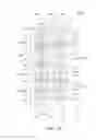 Fig. 02 - Semiconductor device having a metal via