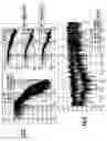 Fig. 06 - Phase-locked loop with filtered quantization noise