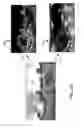 Fig. 20 - Method for High-Quality Panorama Generation with Color, Luminance, and Sharpness Balancing
