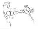 Fig. 01 - Earphone