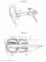 Fig. 02 - Earphone