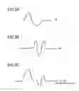 Fig. 03 - Connection state determination system for speakers, acoustic device, and connection state determination method for speakers