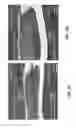 Fig. 04 - FLEXIBLE, STRETCHABLE EPIDERMAL HEATER WITH ON-SITE TEMPERATURE FEEDBACK CONTROL