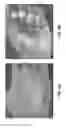 Fig. 05 - FLEXIBLE, STRETCHABLE EPIDERMAL HEATER WITH ON-SITE TEMPERATURE FEEDBACK CONTROL