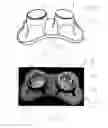 Fig. 03 - A DOUBLE-DINER PET BOWL ASSEMBLY AND A METHOD OF FABRICATING THEREOF