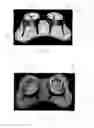Fig. 04 - A DOUBLE-DINER PET BOWL ASSEMBLY AND A METHOD OF FABRICATING THEREOF