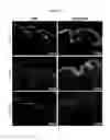 Fig. 10 - PSORIASIS-INDUCED ANIMAL MODEL AND USE THEREOF