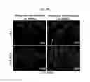 Fig. 12 - PSORIASIS-INDUCED ANIMAL MODEL AND USE THEREOF