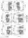 Fig. 17 - Genetically modified non-human animal with human or chimeric PD-L1