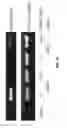 Fig. 20 - Genetically modified non-human animal with human or chimeric PD-L1