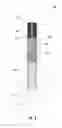 Fig. 04 - Smoking article with heat transfer component