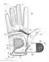 Fig. 01 - Thumb brace
