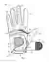 Fig. 03 - Thumb brace