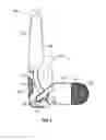 Fig. 04 - Thumb brace