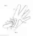 Fig. 08 - Thumb brace