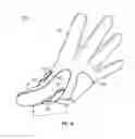 Fig. 10 - Thumb brace