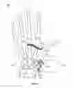 Fig. 11 - Thumb brace