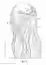 Fig. 07 - Hair Extension Assembly