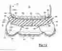 Fig. 10 - Sole structure for article of footwear