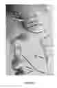 Fig. 05 - Prayer devices