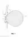 Fig. 02 - CONTACT LENS CONTAINER WITH BIOMARKER DETECTION