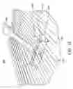 Fig. 11 - Cleaning devices and systems