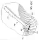 Fig. 14 - Cleaning devices and systems