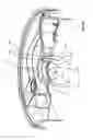 Fig. 19 - Single-use food preparation container assembly, system and method
