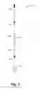 Fig. 07 - PRODUCT, SYSTEM, METHOD, APPARATUS, AND ARTICLE OF MANUFACTURE FOR SHOWER LINER STAY