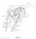 Fig. 07 - Deflectable endoscope and method of use